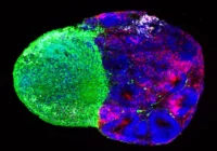 Radial Glia: The Architects of the Human Brain's Complexity